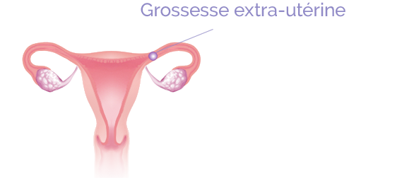 De l'ovulation à la grossesse | IVG info, tout savoir sur l ...